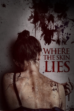 watch-Where the Skin Lies