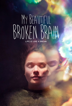 watch-My Beautiful Broken Brain